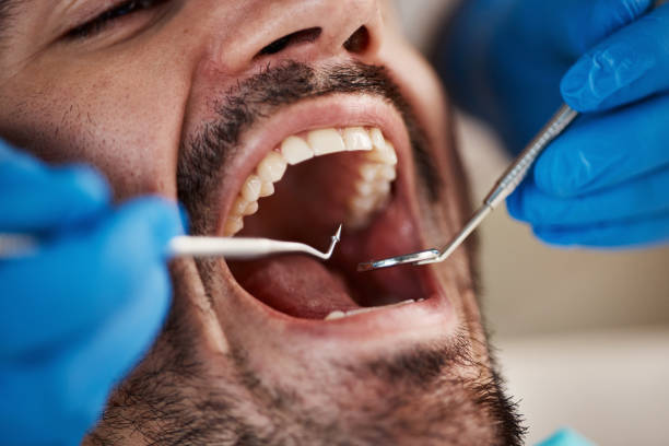 Best Emergency Dental Care for Broken or Chipped Teeth in North Merrick, NY
